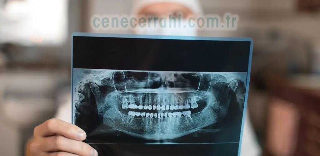  Diş ve Çene Röntgeni